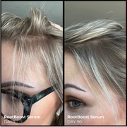 Evolvh Better Roots RootBoost Serum thicker hair